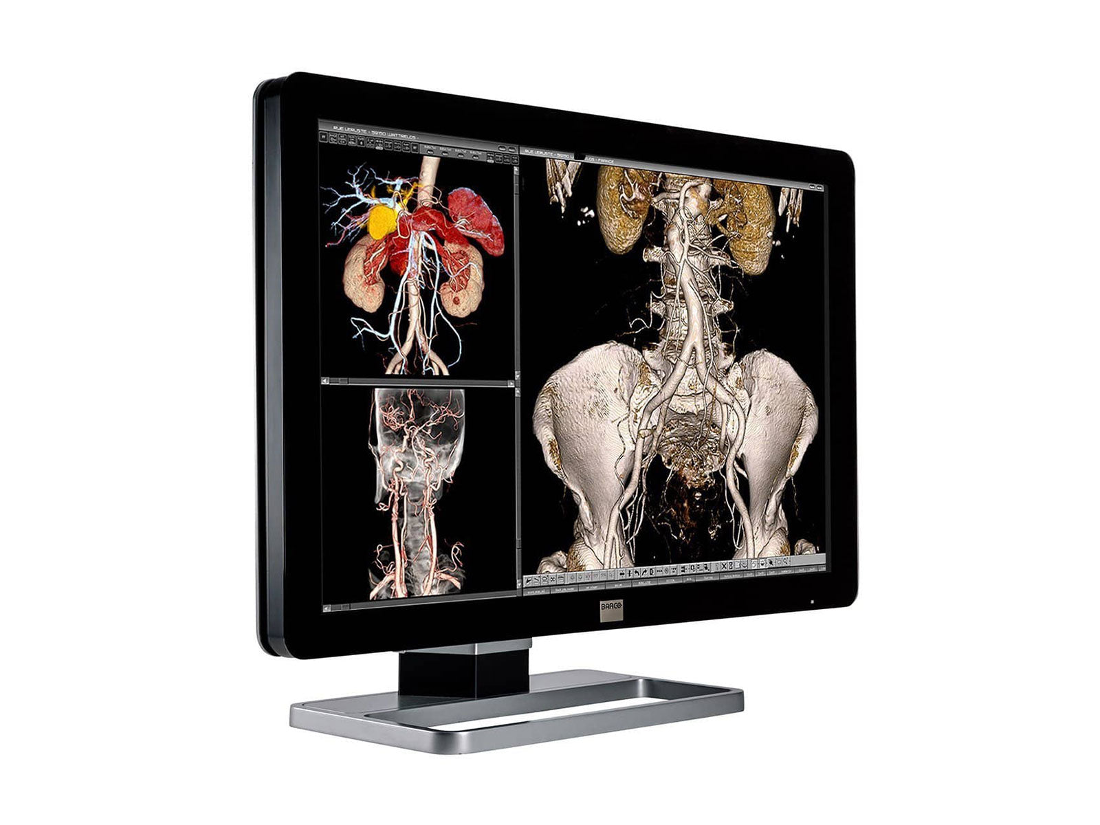Barco Coronis Fusion MDCC-6230 6MP 30" Color LED General Radiology PACS Display