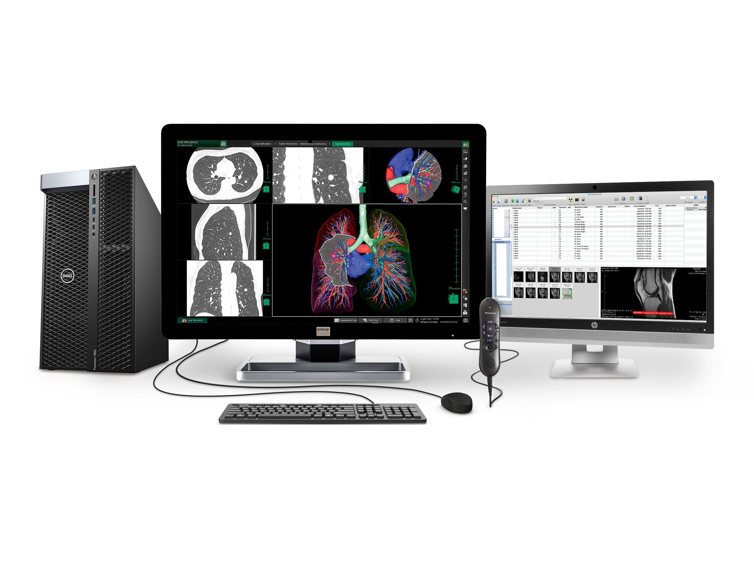 Station complète de radiologie générale PACS | Barco Écran LED couleur 6MP | Poste de travail Dell | Micro de dictée | Moniteur de liste de travail (63307920)
