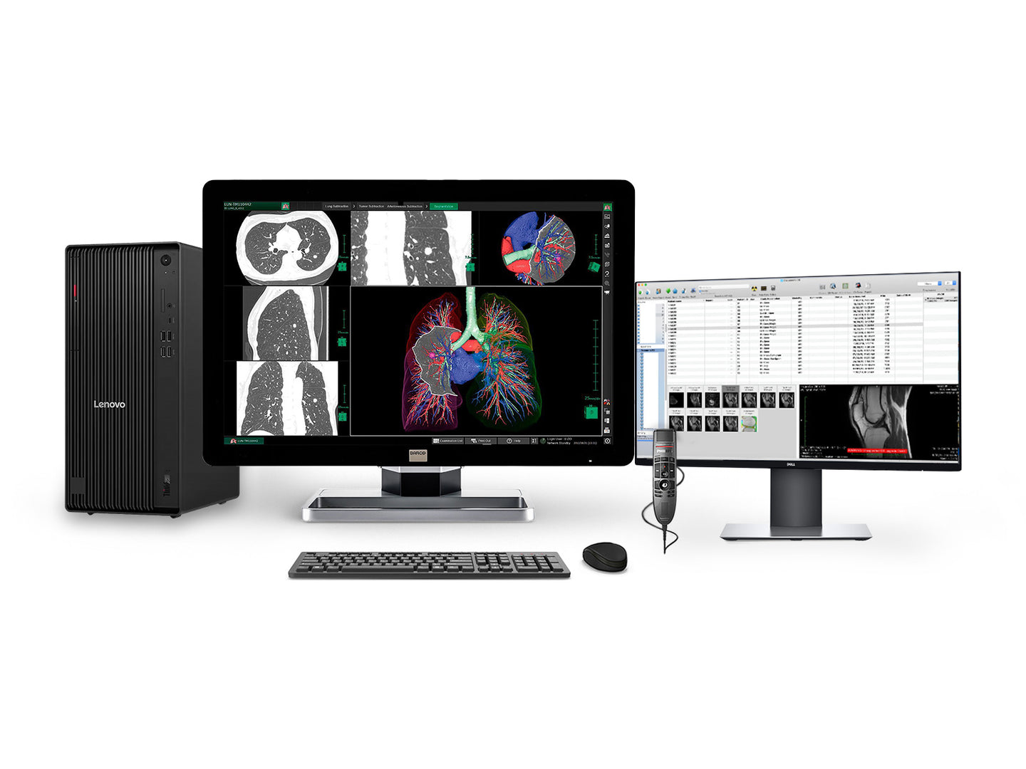 Complete PACS General Radiology Station | Lenovo Workstation