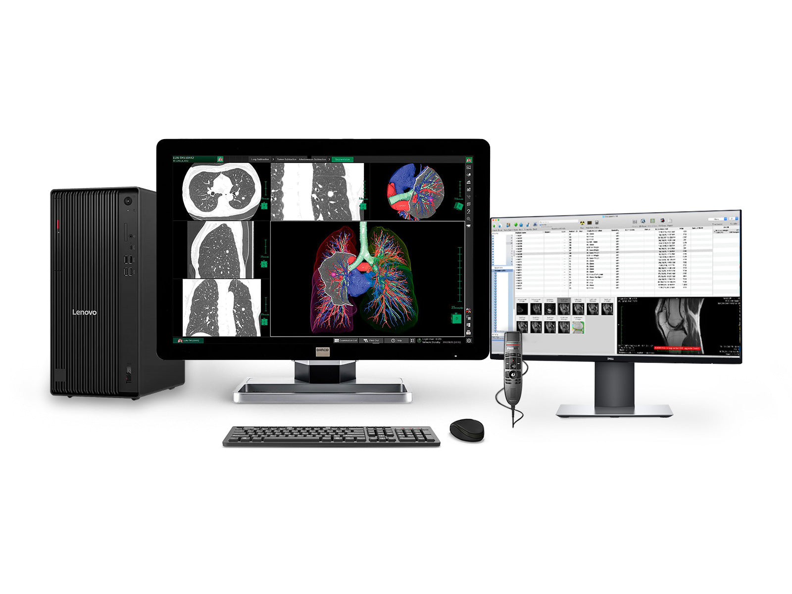 Complete PACS General Radiology Station | Barco Coronis MDCC-6330 6MP Color LED Display | Lenovo Workstation | Dictation Mic | Worklist Monitor (6330Z4R)