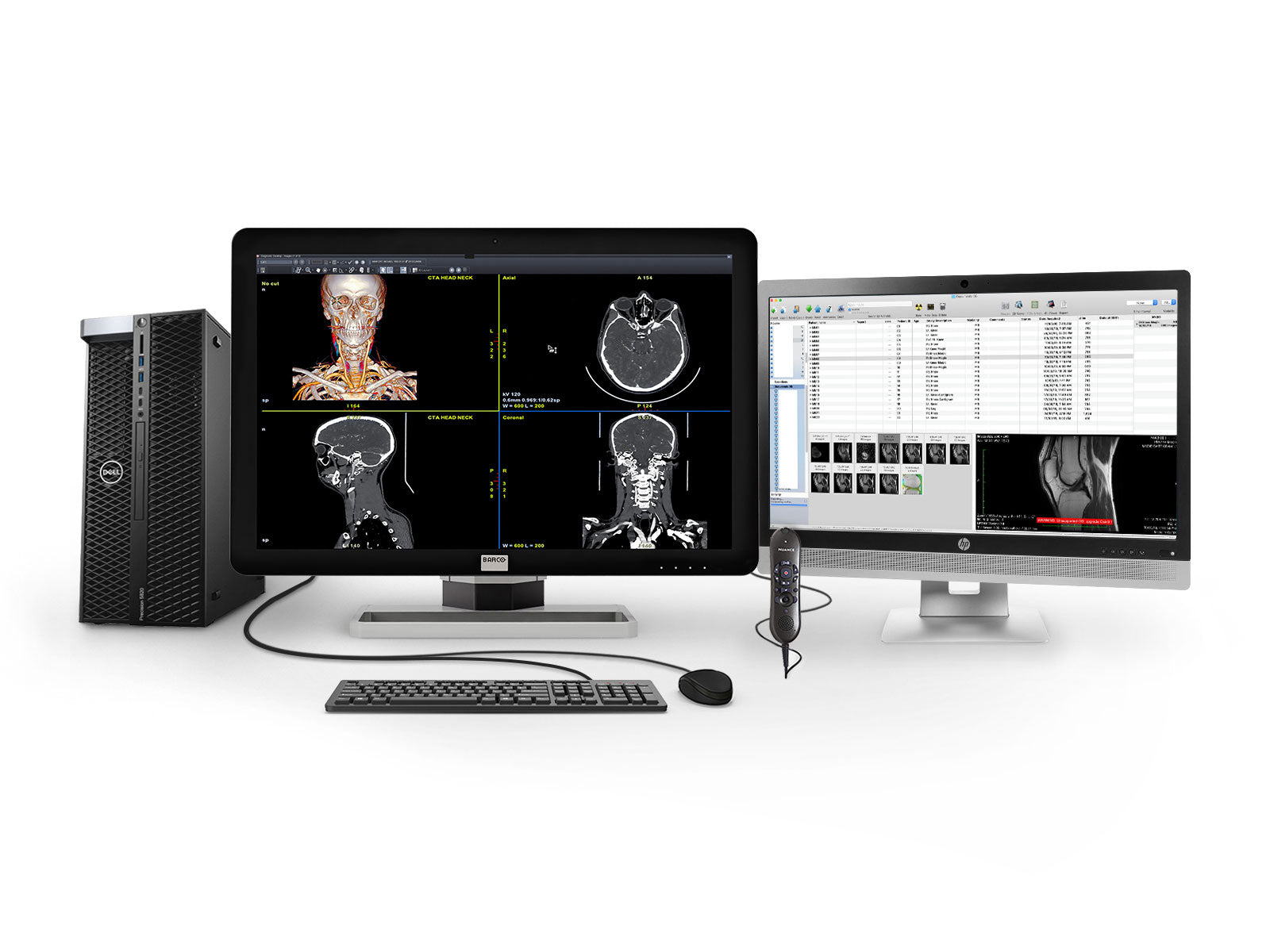 Barco General Radiology Reading Station | Coronis 6MP MDCC-6430 | Dell i9 Workstation | Nuance Mic | 24" Worklist Monitors (64305820) Monitors.com 
