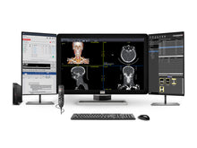 Barco Coronis Fusion MDCC-6430 6MP 30″ Radiology PACS Display + Lenovo ThinkStation P3 Tiny i9‑14900 64GB DDR5 Workstation + Philips SpeechMike Trackball Dictation Mic + Dual 24″ HD Worklist Monitors + Barco MXRT‑4700 GPU + Lenovo Keyboard & Mouse