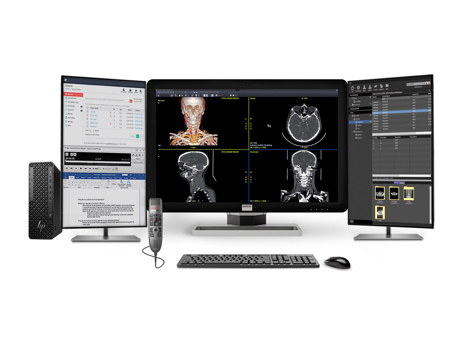 Complete PACS General Radiology Station | Barco Coronis MDCC-6430 6MP Color LED Display | HP Z2 SFF G1i Workstation | Dictation Mic | Worklist Monitor (6430Z4G5)