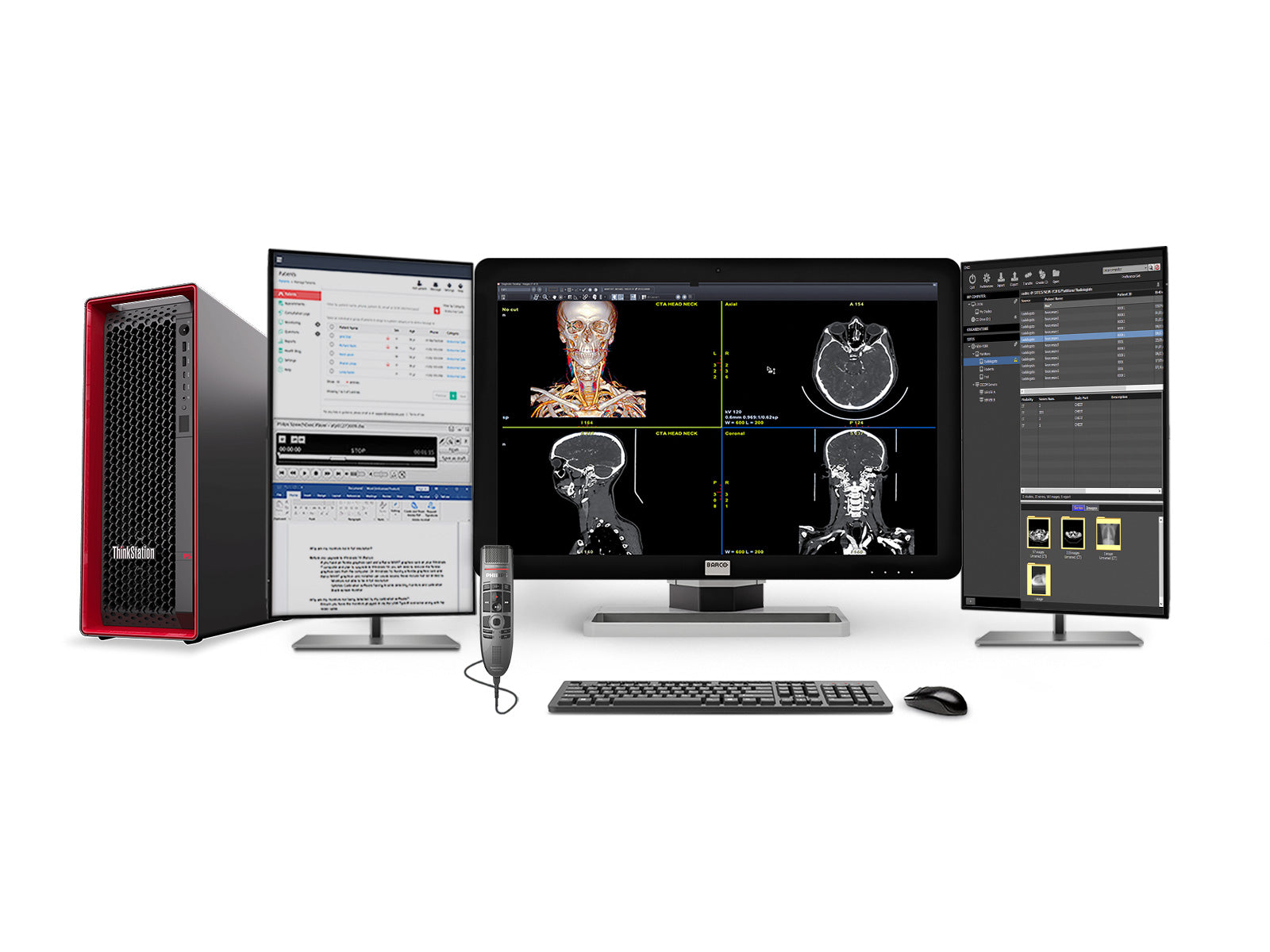 Complete PACS General Radiology Station | Barco Coronis MDCC-6430 6MP Color LED Display | Lenovo P5 Workstation | Dictation Mic | Worklist Monitor (6430Z4G5)