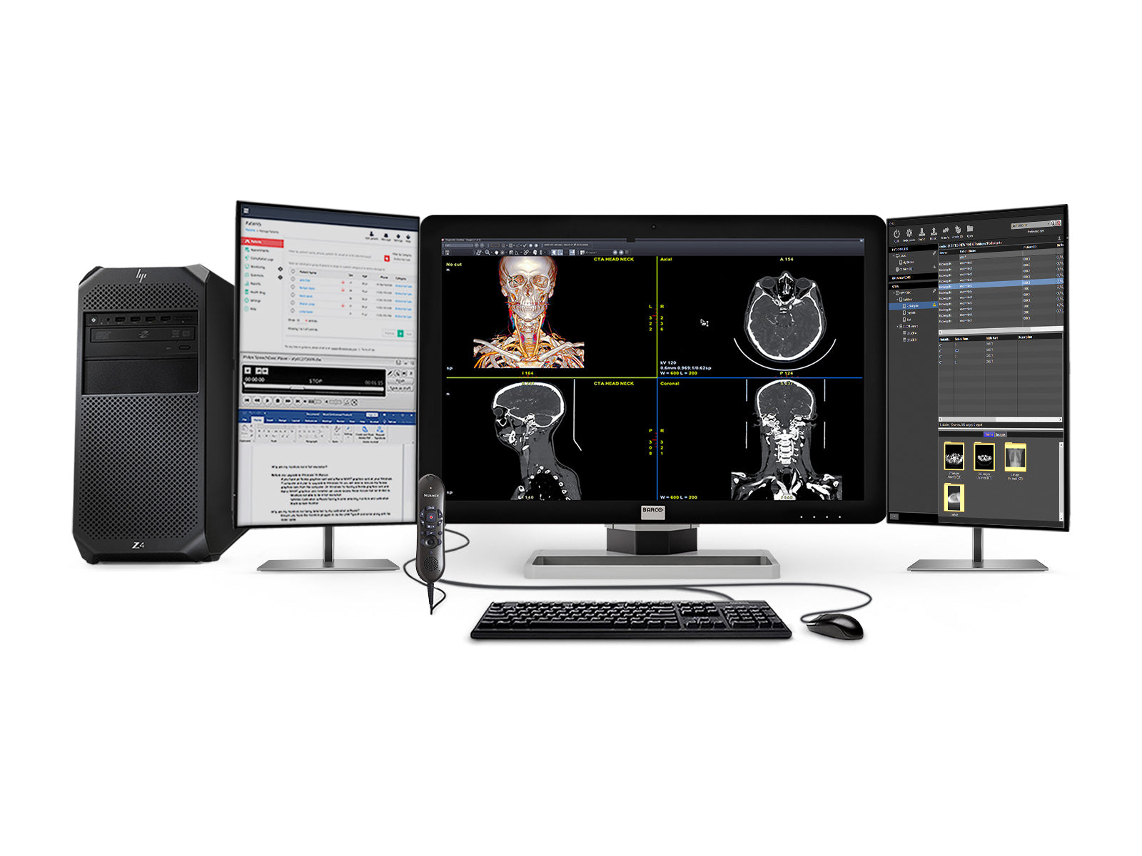Computer Screen With Radiographic Image Complete PACS General Radiology Station | HP Workstation