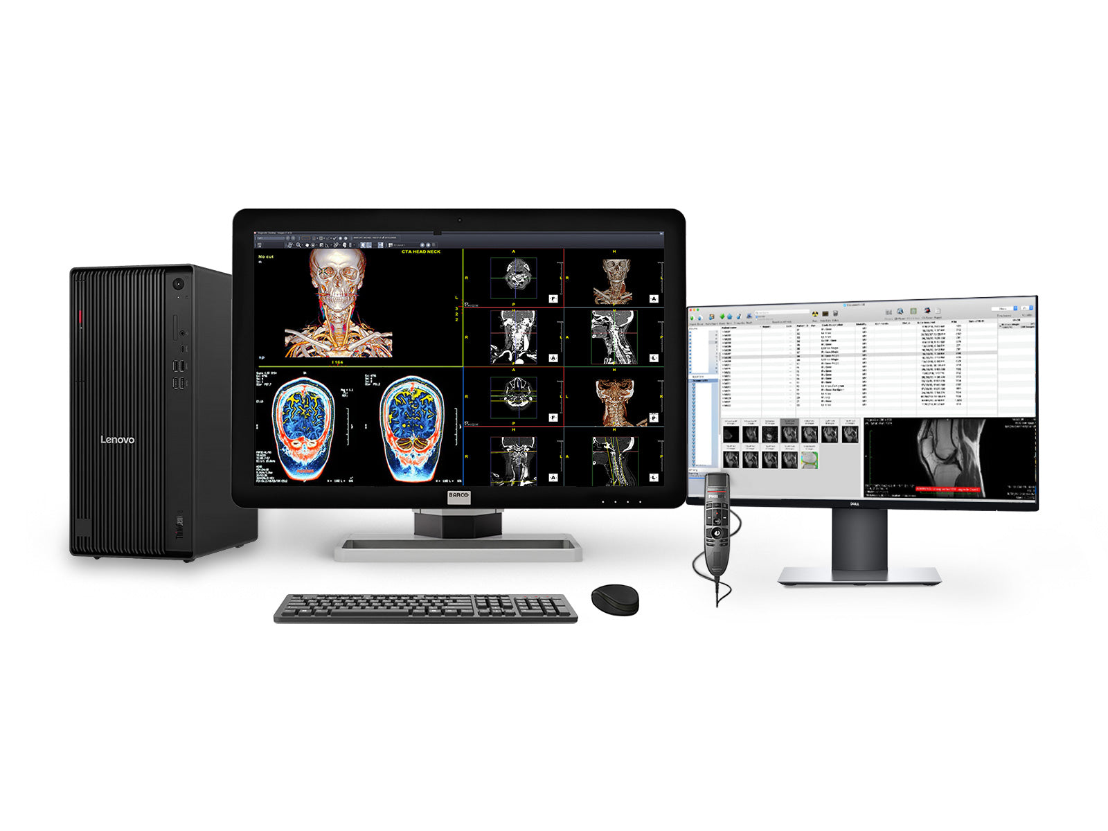 Complete PACS General Radiology Reading Station | Barco 6MP MDCC-6430 | Lenovo Workstation | Dictation Mic | 24" Worklist Monitors (6430Z4R)