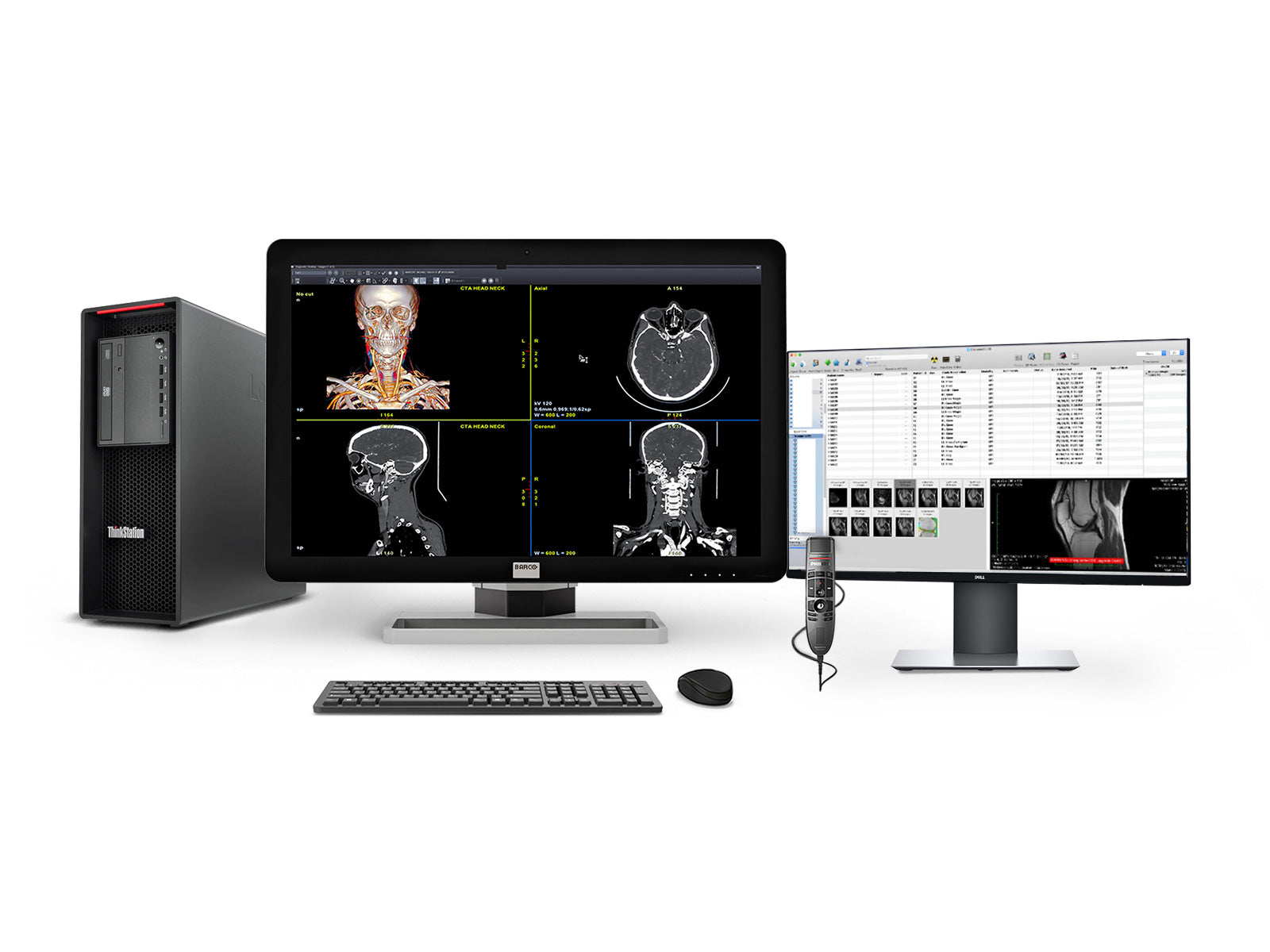 Complete PACS General Radiology Reading Station | Barco 6MP MDCC-6430 | Lenovo Workstation | Dictation Mic | 24" Worklist Monitors (6430Z4R)