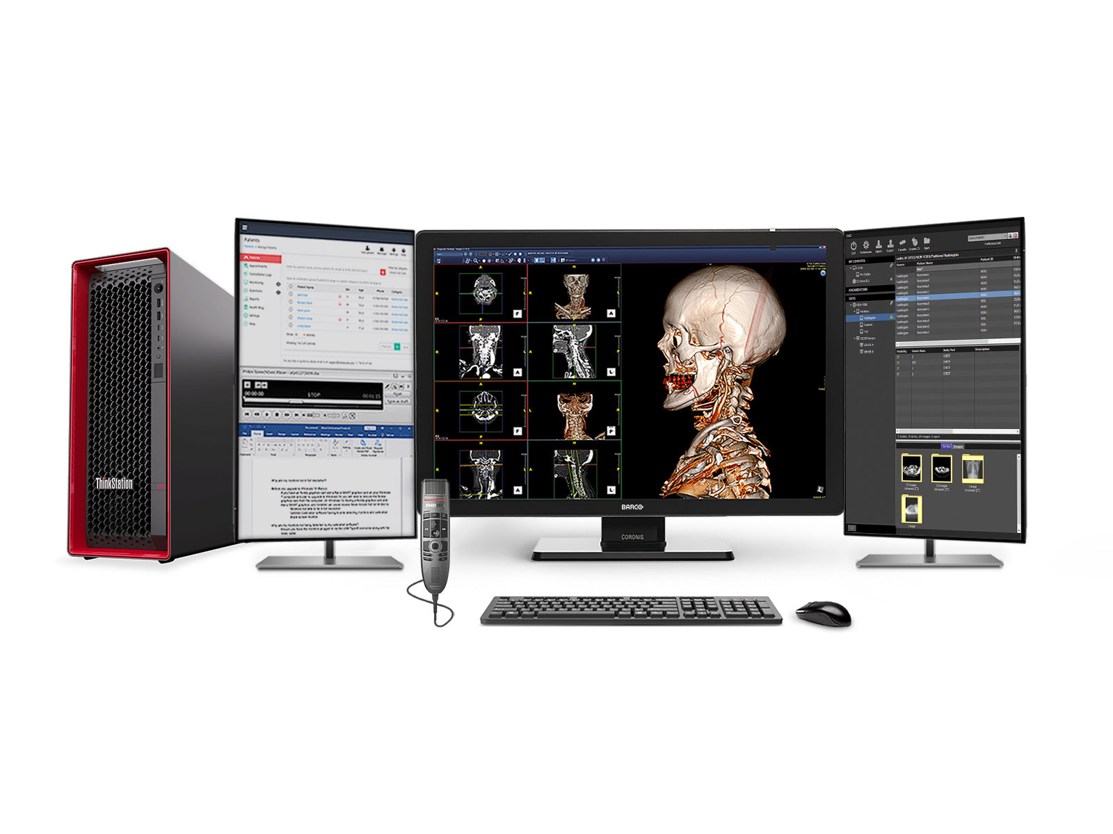 Volledig PACS Algemeen Radiologie Station | Barco Coronis MDCC-6530 6MP Kleuren LED Display | Lenovo P5 Werkstation | Dictatiemicrofoon | Werklijstmonitor (6530Z4G5)