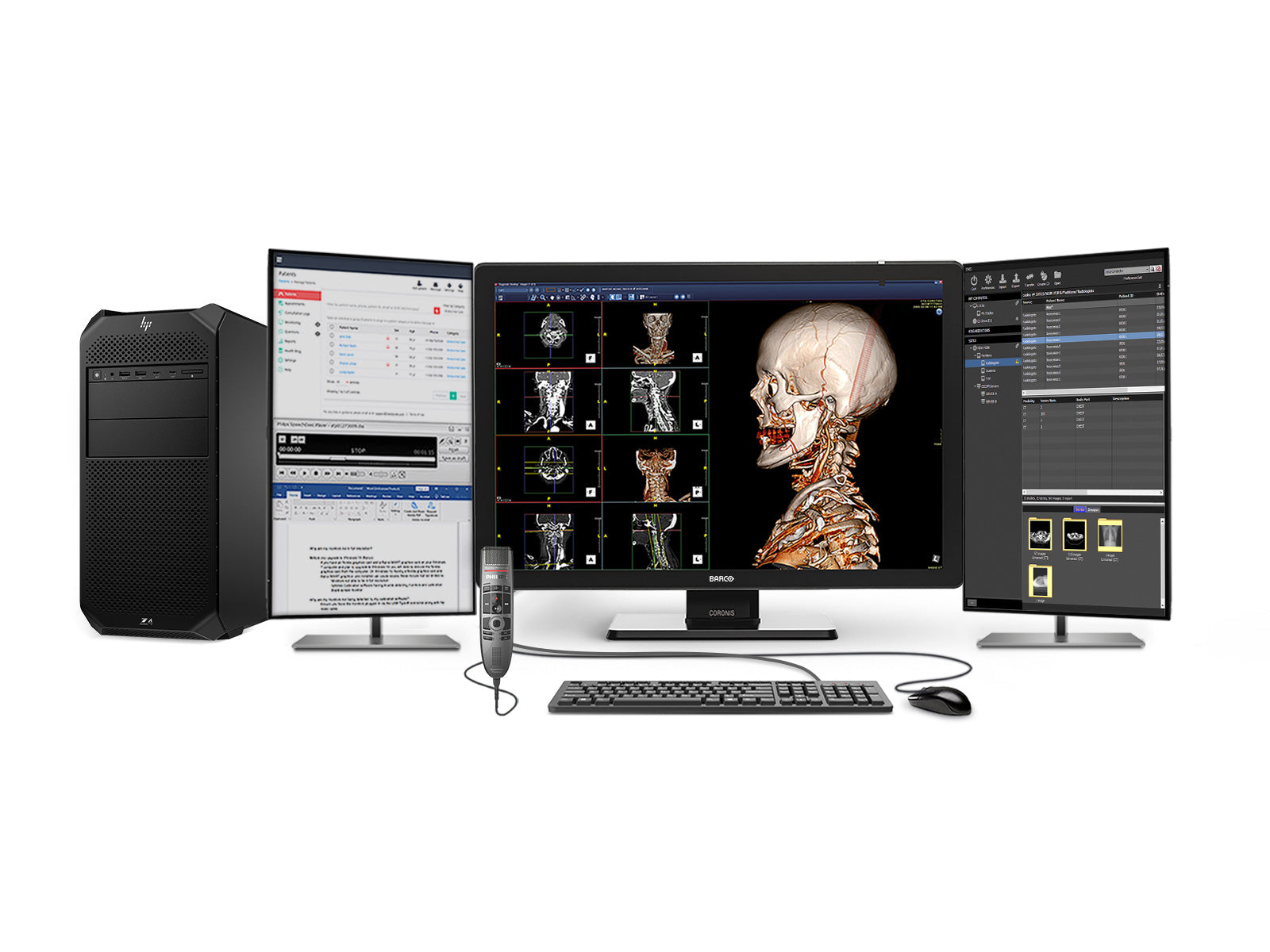 Complete PACS General Radiology Station | Barco 6MP Color LED Display | HP Z4 G5 Workstation | Dictation Mic | Worklist Monitor (6530Z4G5)