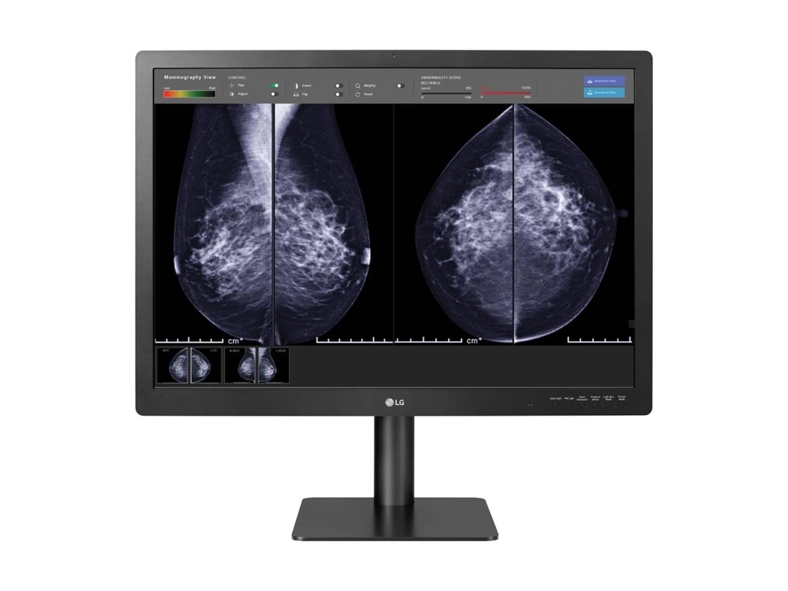 LG 12MP Fusion 31.5" Color Mammography 3D-Tomosynthesis Breast Imaging Display (31HN713D)