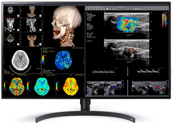 LG 8MP Fusion 4K 32" Farbe Medizinische Diagnostik 
Radiologie-Monitor
