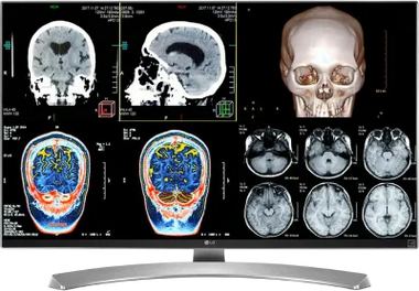 LG 8MP 27" Clinical Review Monitor
