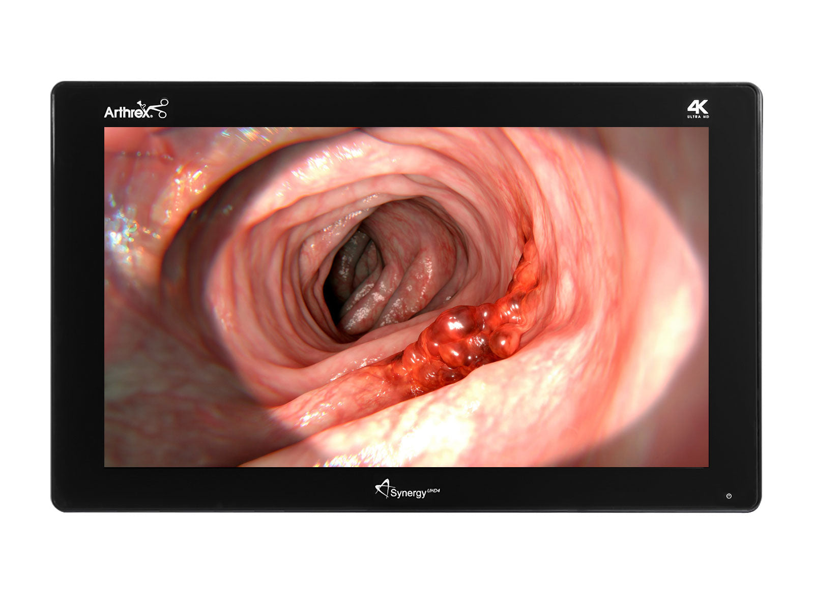 Barco Synergie ArthrexUHD4 Moniteur d'affichage médical chirurgical couleur 32K 4" (AR-3250-3210)