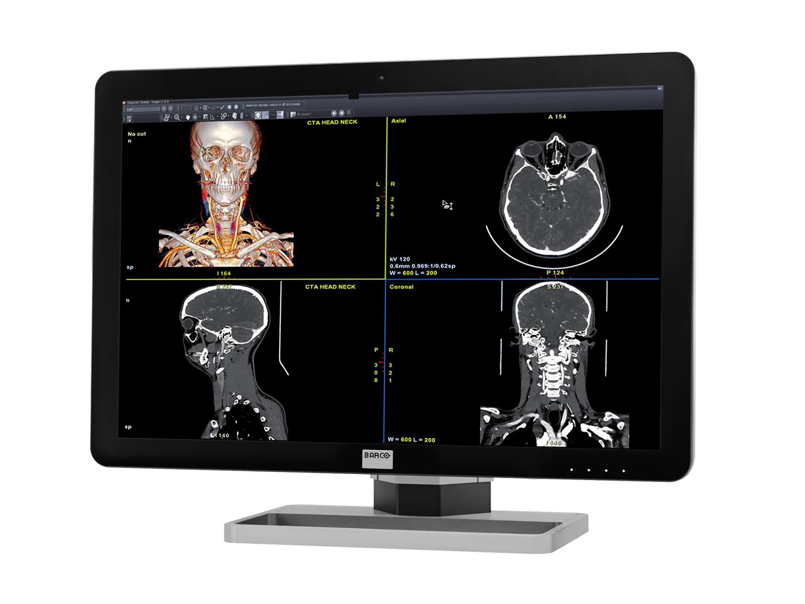 Barco-Coronis-Fusion-MDCC-6430