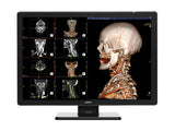 Barco Coronis Fusion MDCC-6530 6MP Moniteur de radiologie diagnostique médicale couleur 30