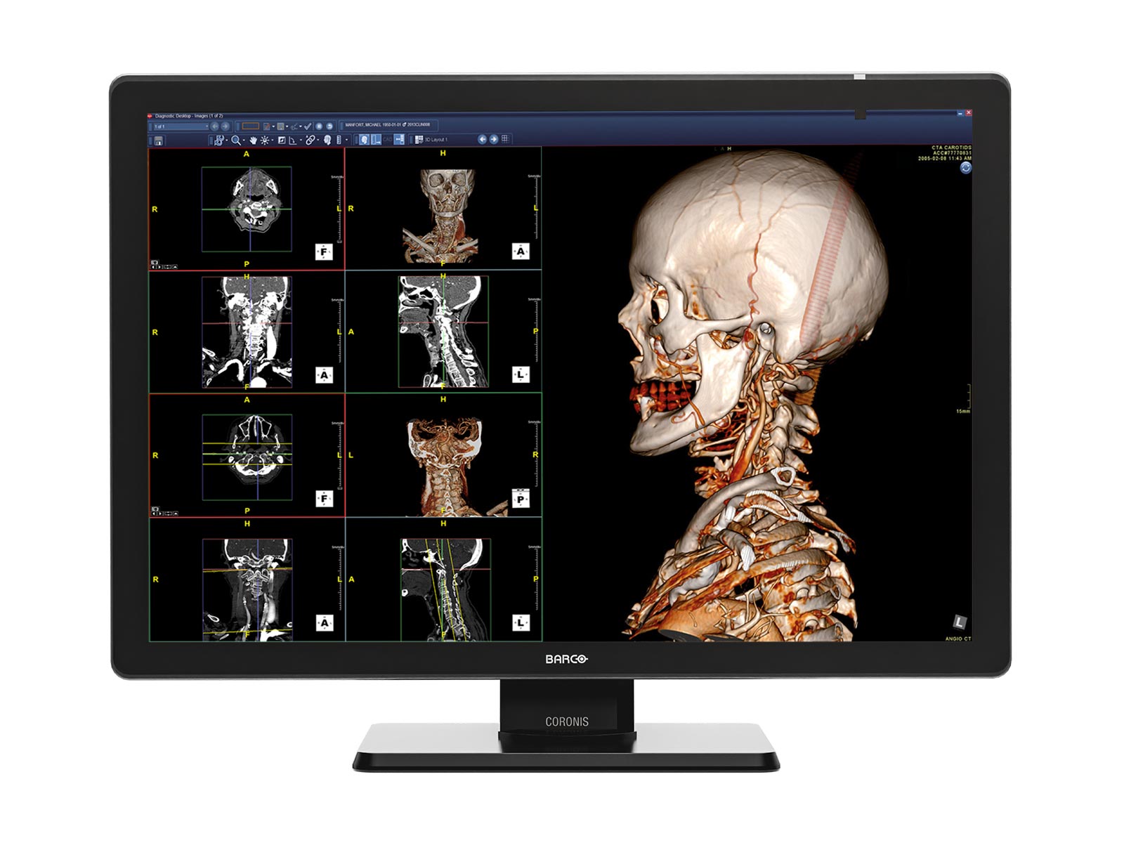 Complete PACS General Radiology Station | Barco 6MP Color LED Display | HP Z4 G5 Workstation | Dictation Mic | Worklist Monitor (6530Z4G5)