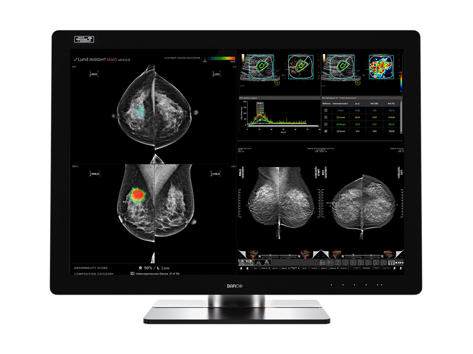 Complete Mammography Reading Station | Barco Coronis UNITI MDMC-12133 12MP | HP Z4 G5 Workstation | Dictation Mic | Worklist Monitors (12133Z4G5R)
