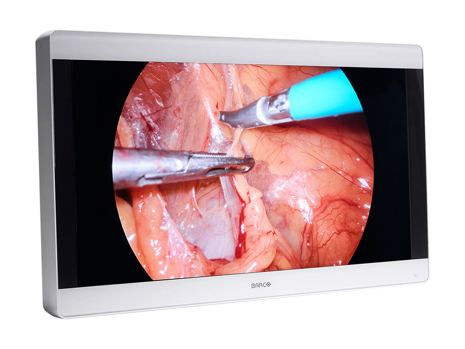 Barco MDSC-8232 31-Zoll-LED-4K-Farb-Chirurgiemonitor mit medizinischem Display (K9307922) Monitors.com