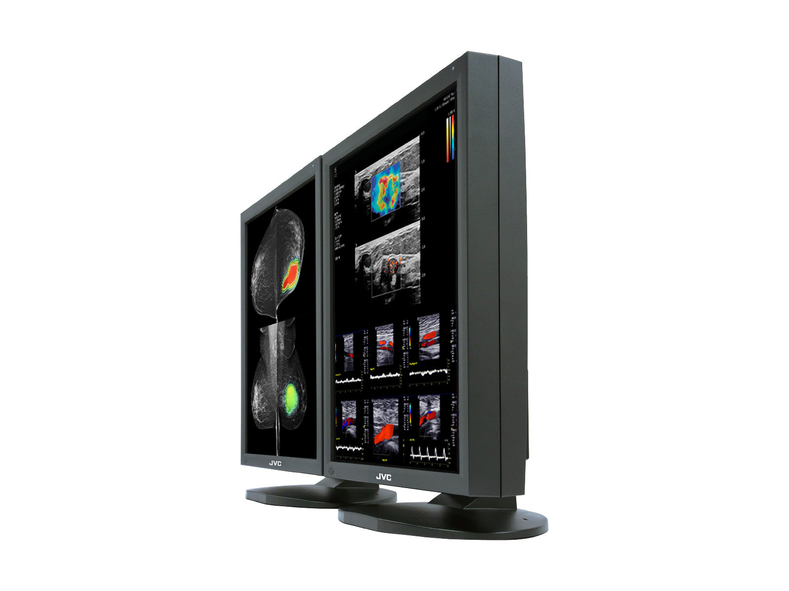 JVC Totoku CCL550i2 5MP 21" Color LED Mammo 3D-DBT Pantalla de imágenes de mama (CCL550i2)