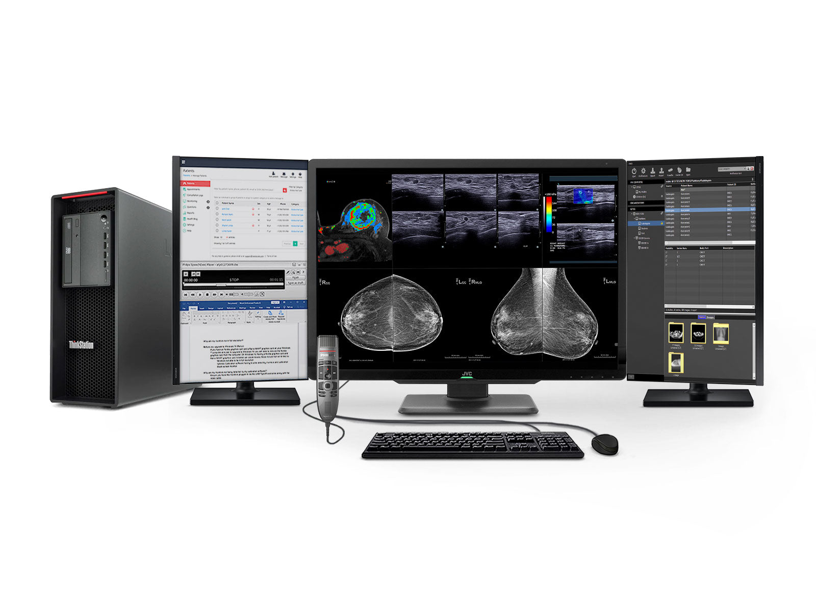 Complete Mammography Reading Station | JVC Totoku 12MP Color Display | Lenovo Workstation | Dictation Mic | Worklist Monitors (CLS1200P520)