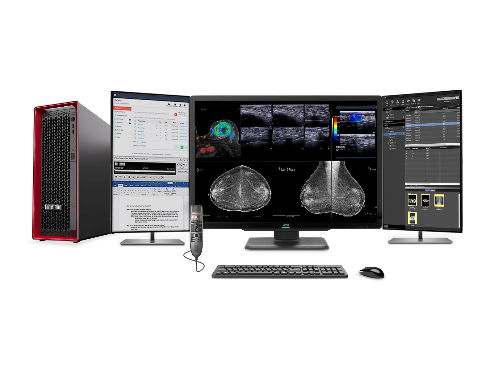 Complete Mammografie Leesstation | JVC Totoku CL-S1200 12MP Kleurenscherm | Lenovo P5 Werkstation | Dicteermicrofoon | Werklijstmonitoren (CLS1200Z4G5)