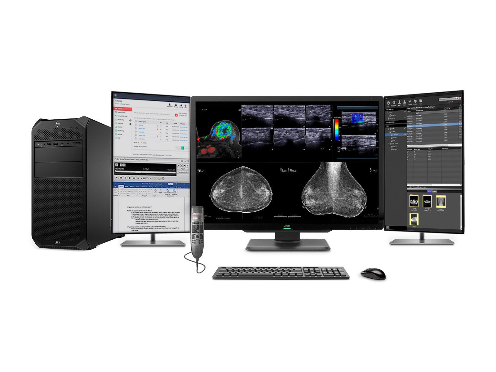 Stazione di lettura mammografica completa | JVC Totoku CL-S1200 12MP Display a colori | HP Z4 G5 Postazione di lavoro | Microfono per dettatura | Monitor della lista di lavoro (CLS1200Z4G5) 