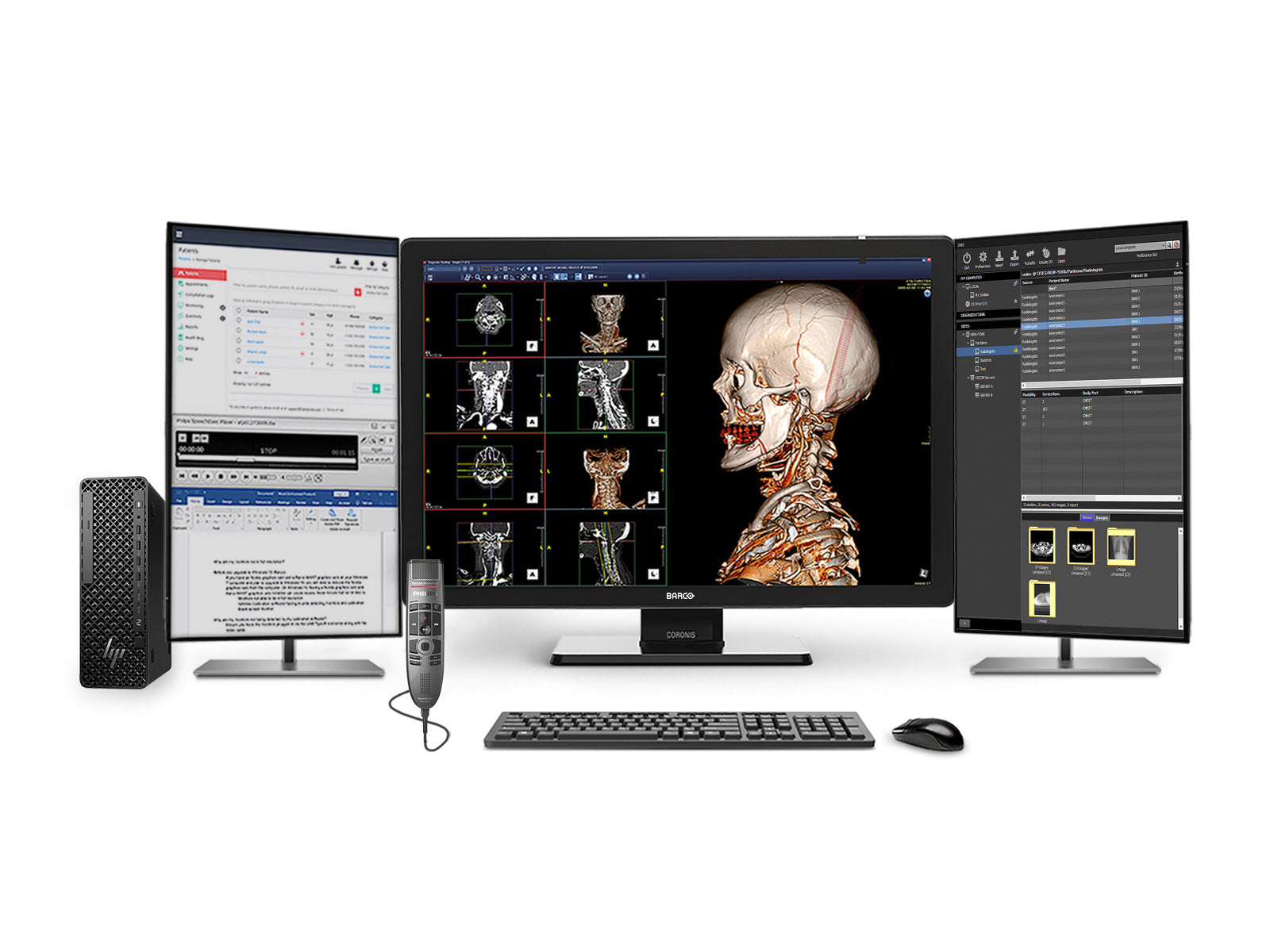 Complete PACS General Radiology Station | Barco Coronis MDCC-6530 6MP Color LED Display | HP Z2 SFF G1i Workstation | Dictation Mic | Worklist Monitor (6530Z4G5)