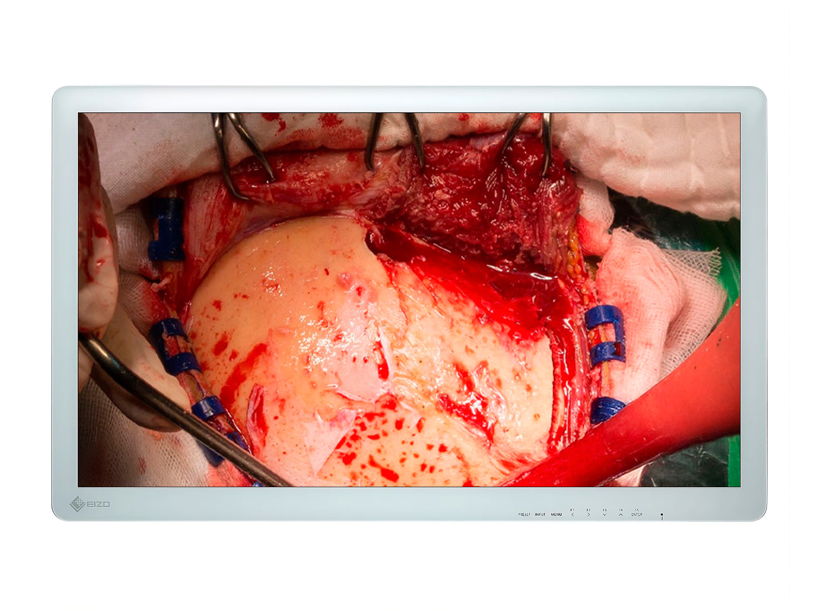 Eizo 31.5" FHD Surgical Display Monitor (EX3220)