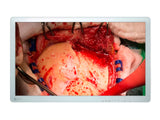 Eizo CuratOR 31,5-inch FHD chirurgische endoscopie medische beeldschermmonitor (EX3220)