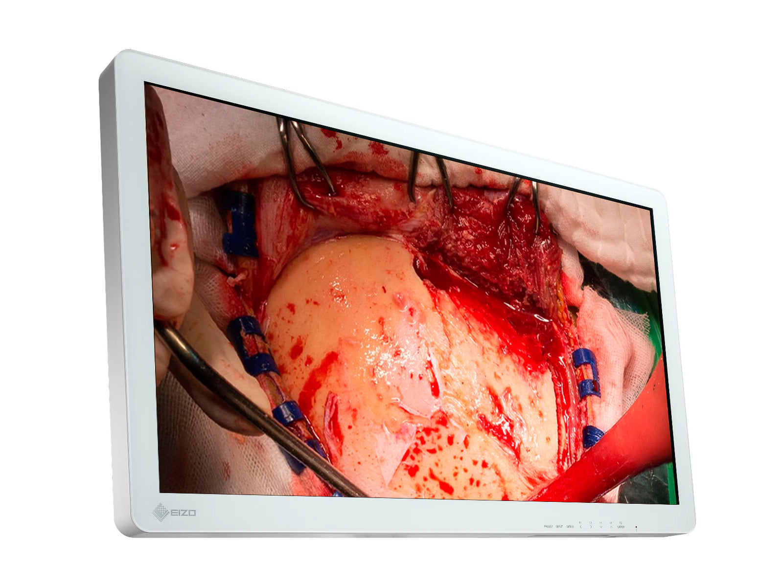 Eizo 31.5" FHD Surgical Display Monitor (EX3220)