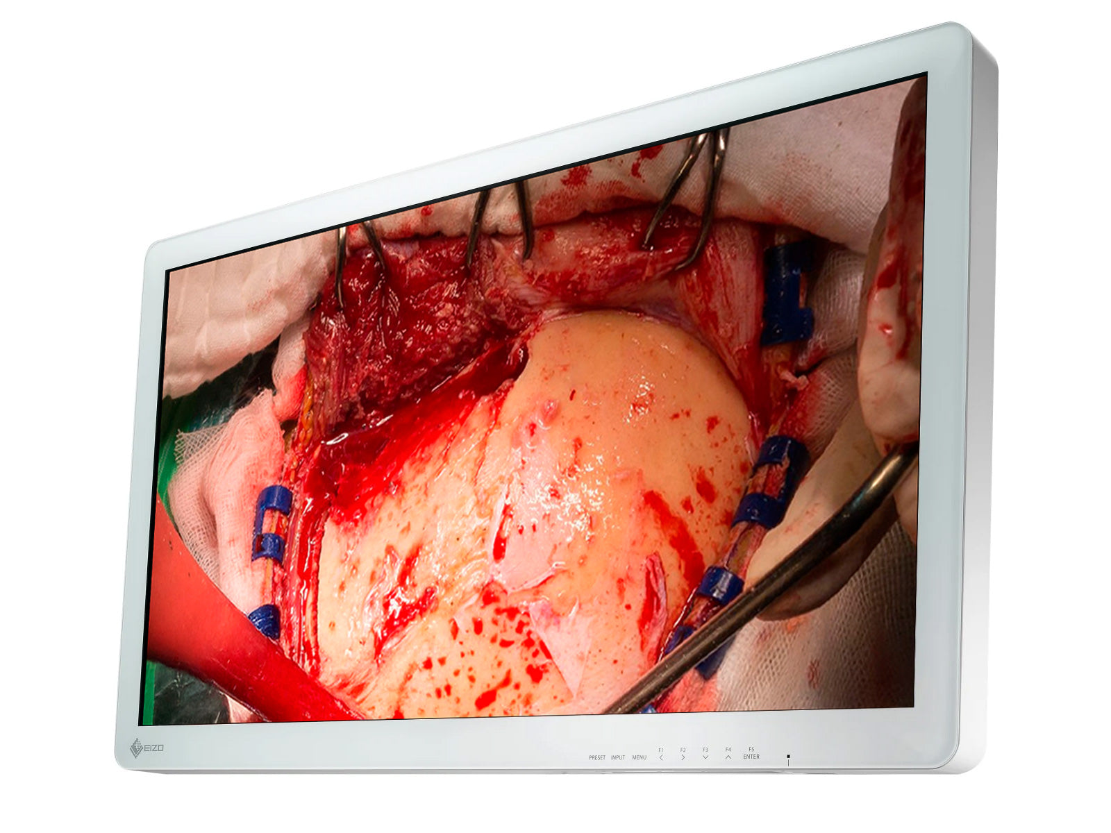 Eizo 31.5" FHD Surgical Display Monitor (EX3220)