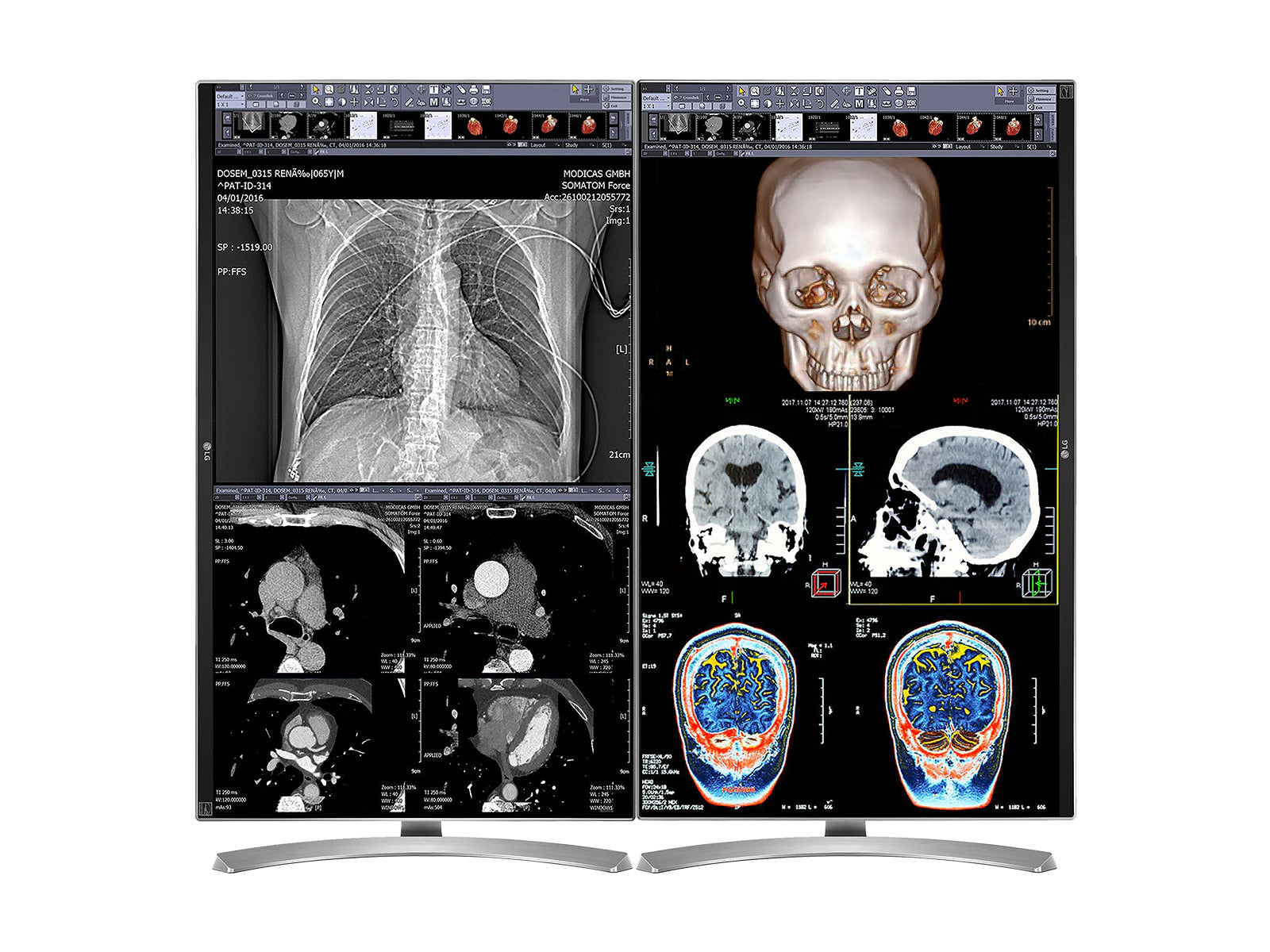 Komplette Lesestation für klinische Überprüfungen | 2 x LG 27" 8MP Farbdisplays für klinische Überprüfung | HP ZBook Studio 16 G10 | Diktiermikrofon | PerfectLUM Kalibrierpaket (LGHP16G10)