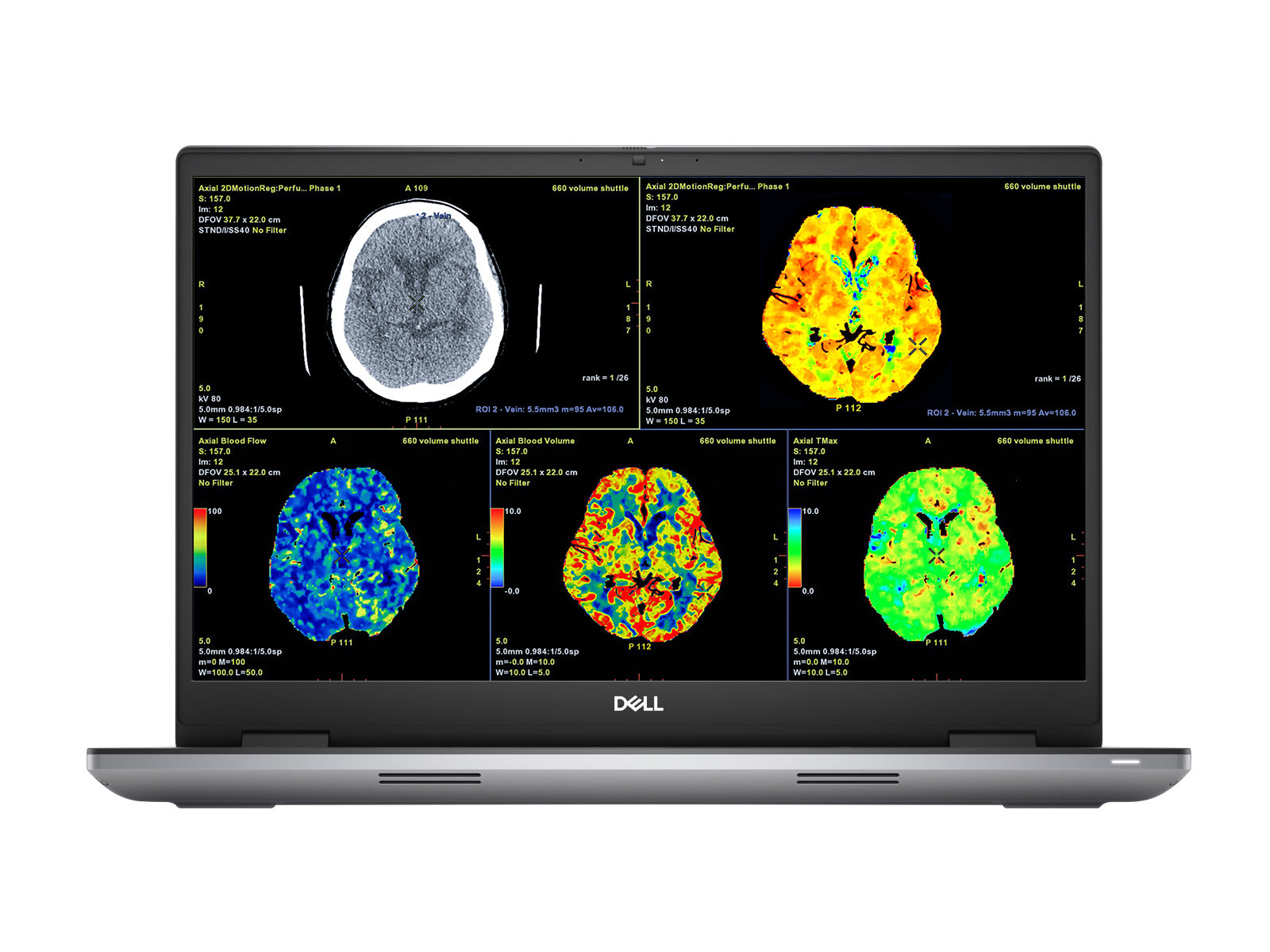 Dell Precision 7770 Mobile Radiology Workstation | 17.3" 8MP 4K UHD DICOM Calibrated | Core i7-12850HX @ 4.8GHz | 128GB DDR5 | 1TB NVMe SSD | RTX A3000 12GB | WiFi 6E