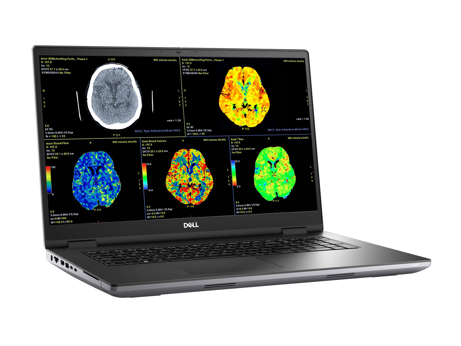 Dell Precision 7770 Mobile Radiology Workstation | 17.3" 8MP 4K UHD DICOM Calibrated | Core i7-12850HX @ 4.8GHz | 128GB DDR5 | 1TB NVMe SSD | RTX A3000 12GB | WiFi 6E