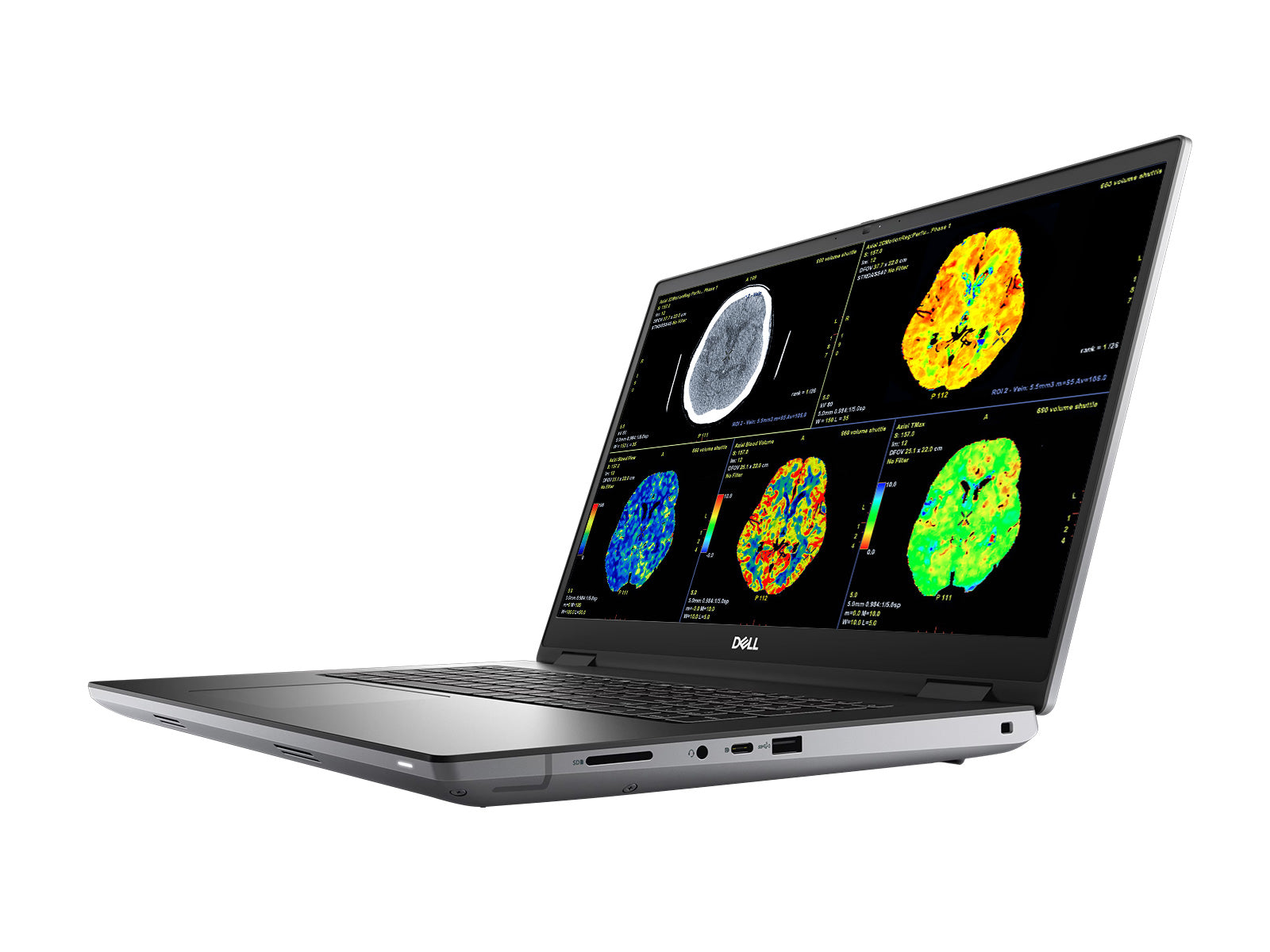 Dell Precision 7770 Mobile Radiology Workstation | 17.3" 8MP 4K UHD DICOM Calibrated | Core i7-12850HX @ 4.8GHz | 128GB DDR5 | 1TB NVMe SSD | RTX A3000 12GB | WiFi 6E