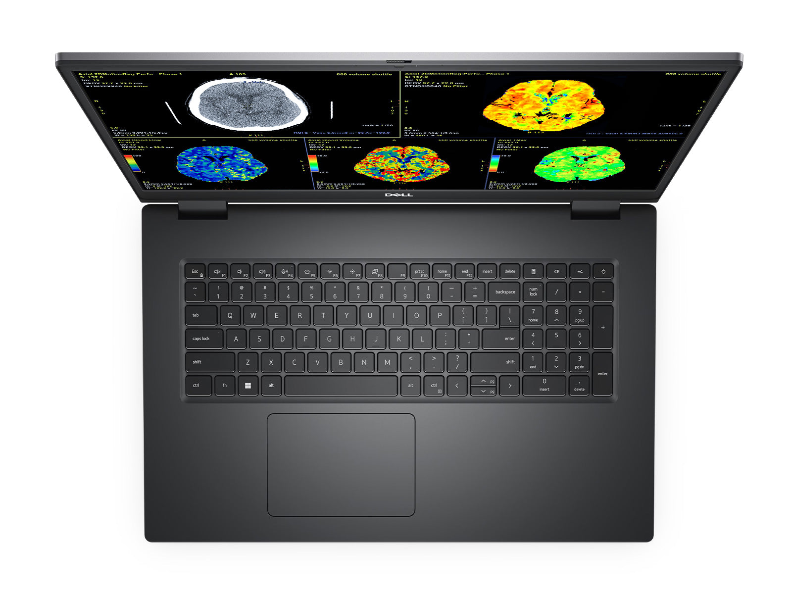 Dell Precision 7770 Mobile Radiology Workstation | 17.3" 8MP 4K UHD DICOM Calibrated | Core i7-12850HX @ 4.8GHz | 128GB DDR5 | 1TB NVMe SSD | RTX A3000 12GB | WiFi 6E