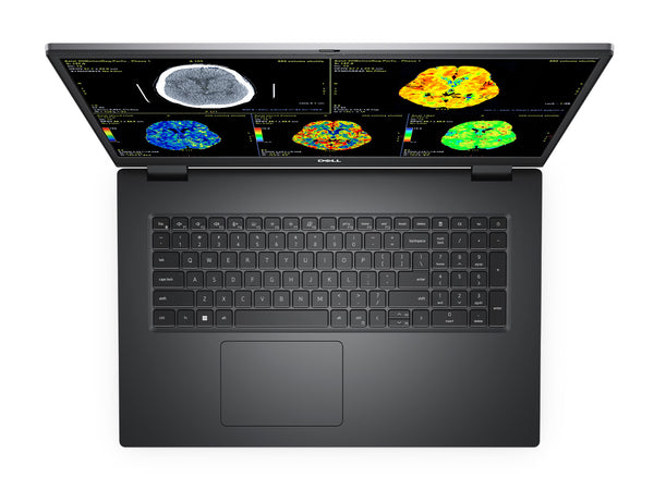 Dell Precision 7770 Mobile Radiology Workstation | 17.3