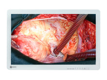 Eizo EX2620 LED 26" FHD Surgical LCD Monitor (EX2620)