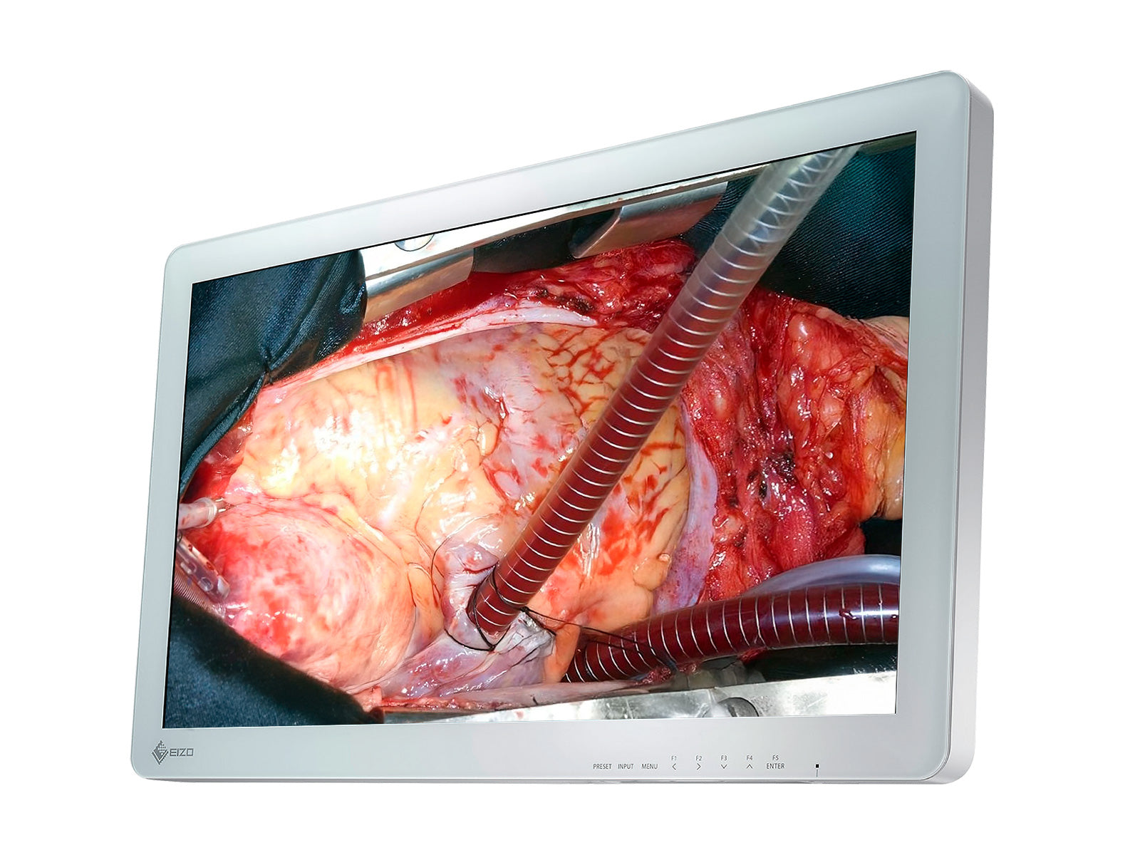 Eizo Moniteur LCD chirurgical LED 26" FHD EX2620