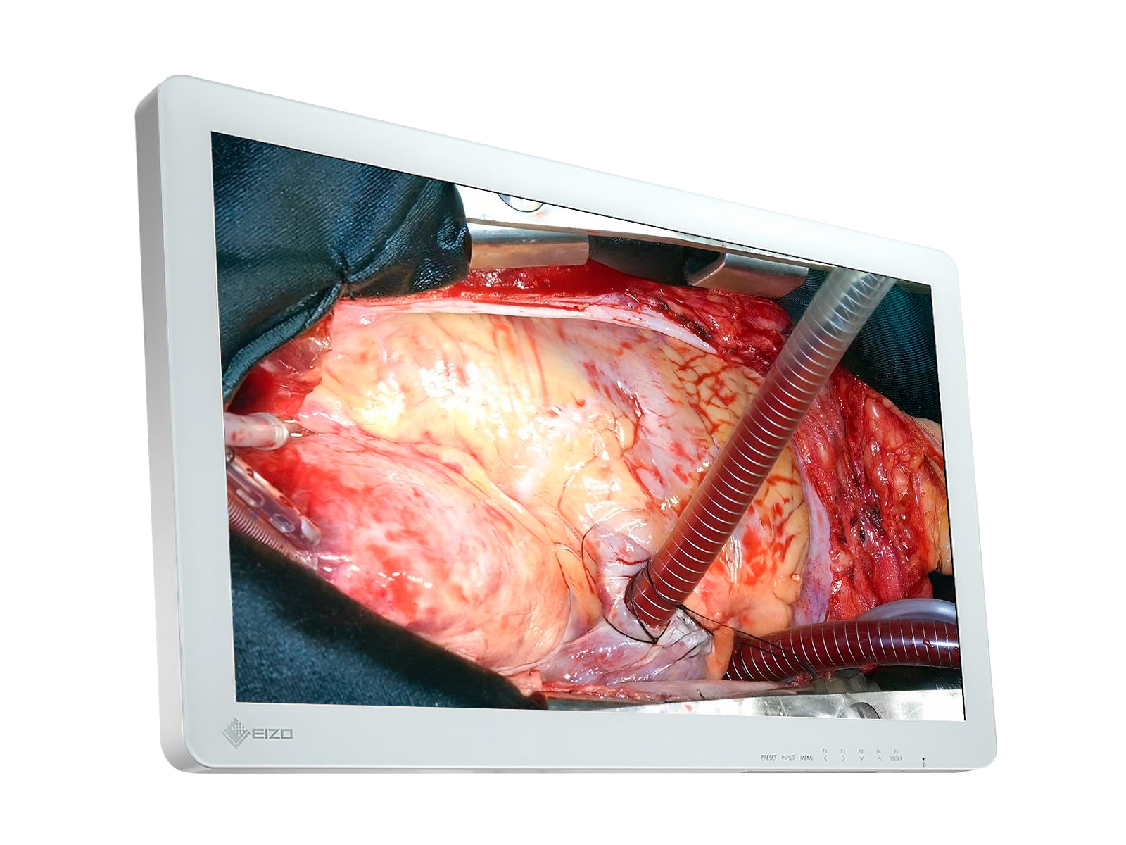 Eizo Moniteur LCD chirurgical LED 26" FHD EX2620