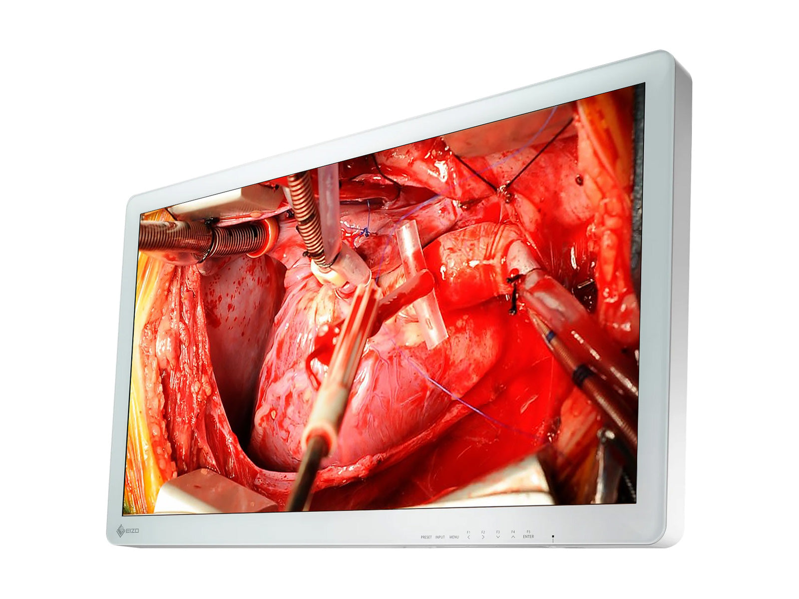 Eizo 26" FHD Surgical LCD Display Monitor (EX2621)