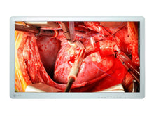 Eizo 26" FHD Surgical LCD Display Monitor (EX2621)