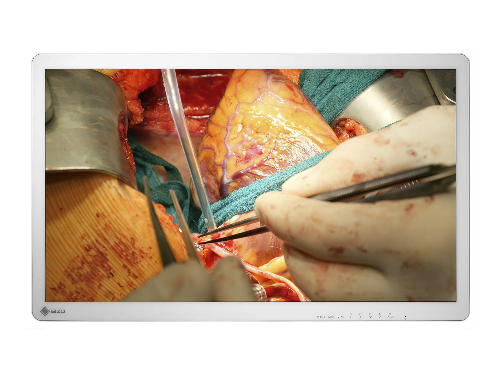 Eizo 32" 4K UHD Surgical Display Monitor (EX3242)