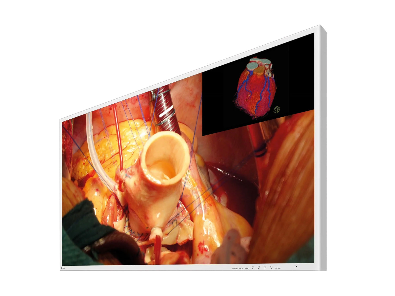 Eizo 43" 4K UHD Surgical Display Monitor (EX4342)