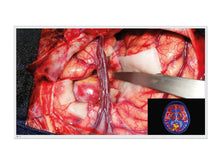 Eizo CuradorOR 55" 4K Monitor de pantalla médico quirúrgico UHD (EX5542)