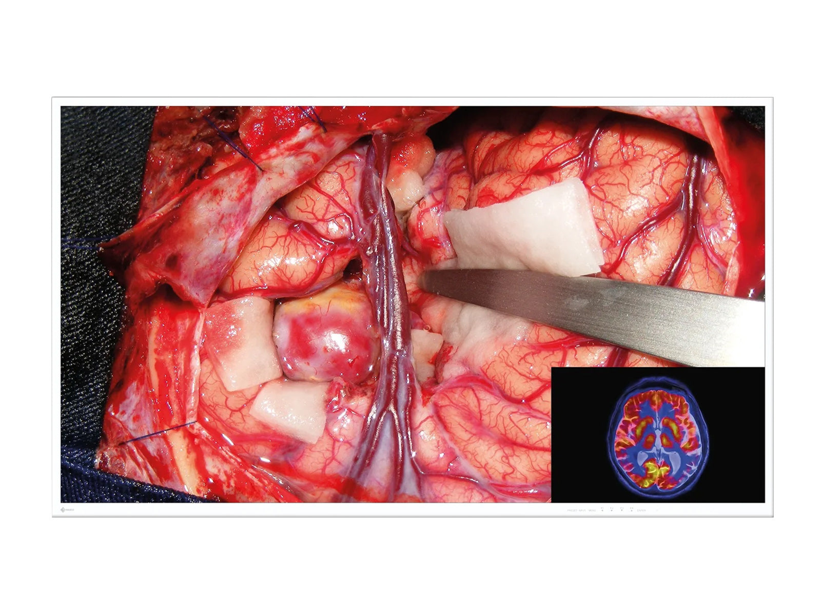 Eizo CuratOR 55" 4K UHD Surgical Medical Display Monitor (EX5542)