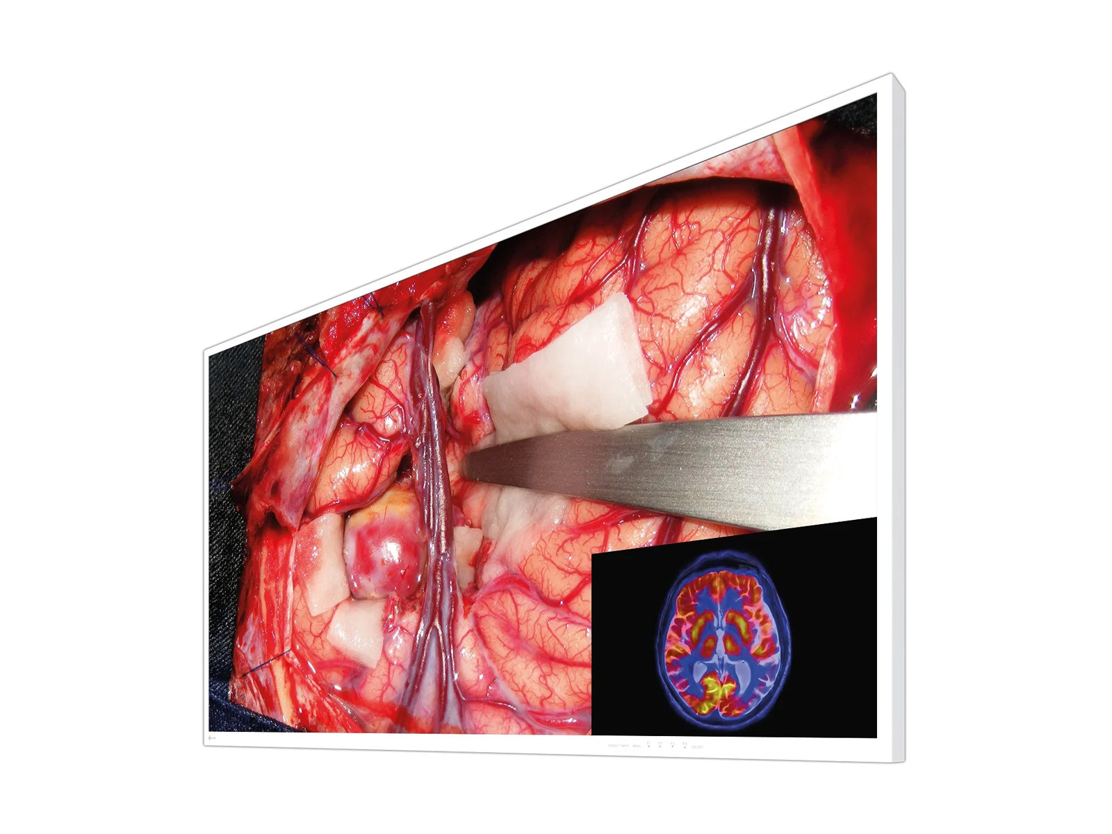 Eizo CuratOR 55" 4K UHD Surgical Medical Display Monitor (EX5542)