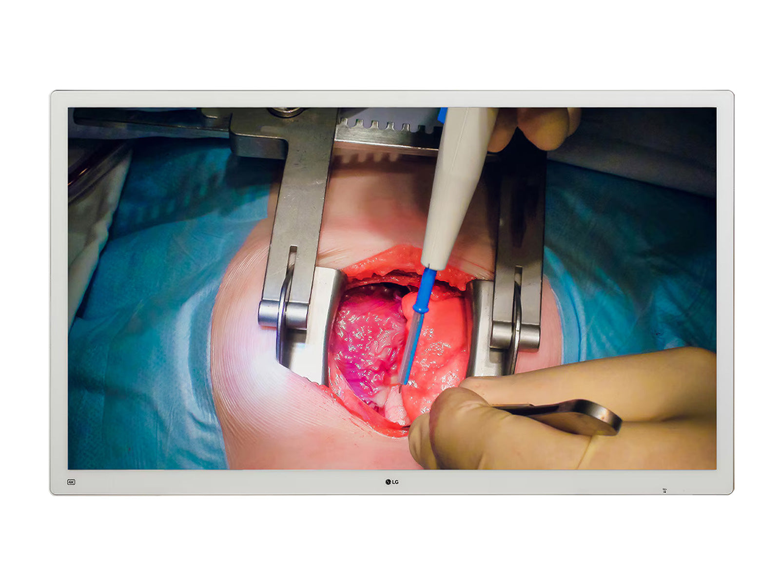 LG 55'' 55MH5K 4K Monitor médico quirúrgico IPS 12G-SDI