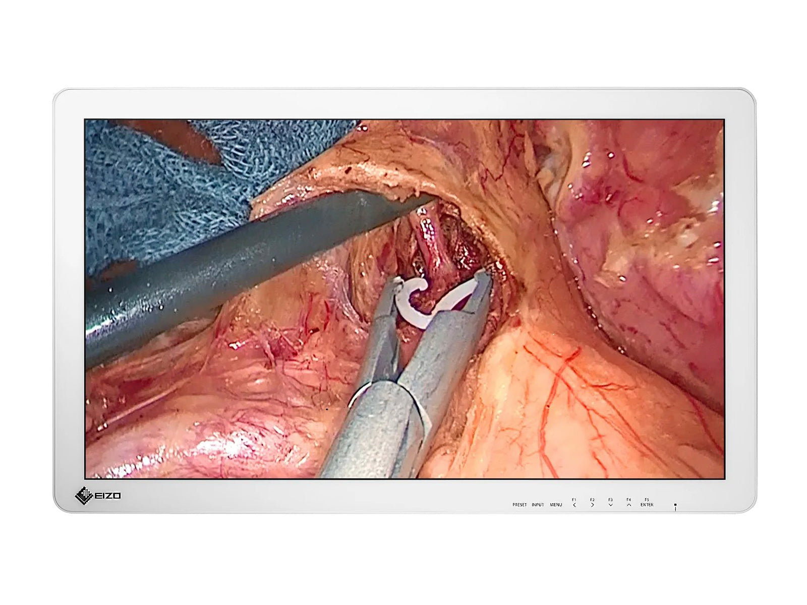 Eizo 27" FHD Surgical Display Monitor (EX2721)