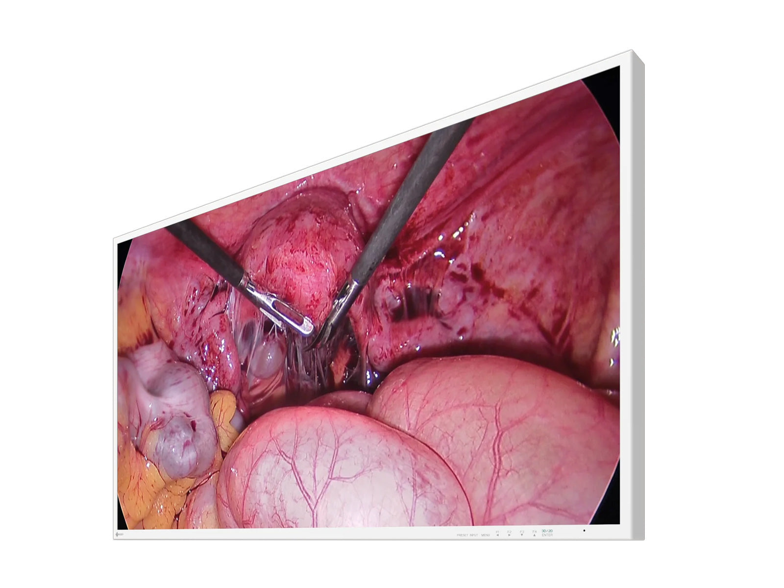 Eizo 43" 4K 3D UHD Surgical Display Monitor (EX4342-3D)